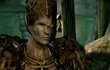 Dragon Age : Origins - Awakening