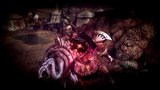 Vido Soul Sacrifice Delta | Quelques phases de gameplay